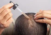Anti-chute cheveux