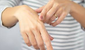 Soins des cicatrices