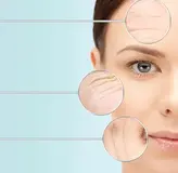 Soins anti-âge